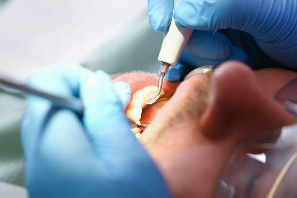 Best Cosmetic Emergency Dentistry in Aberdeen, OH
