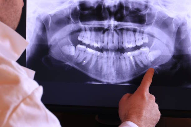 Best Emergency Tooth Extraction in Aberdeen, OH